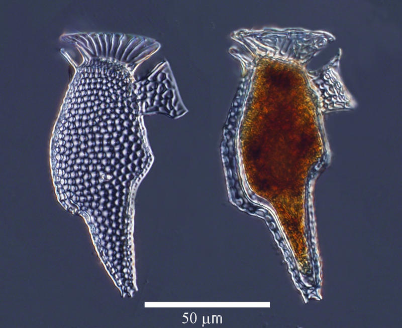 Dinophysis caudata