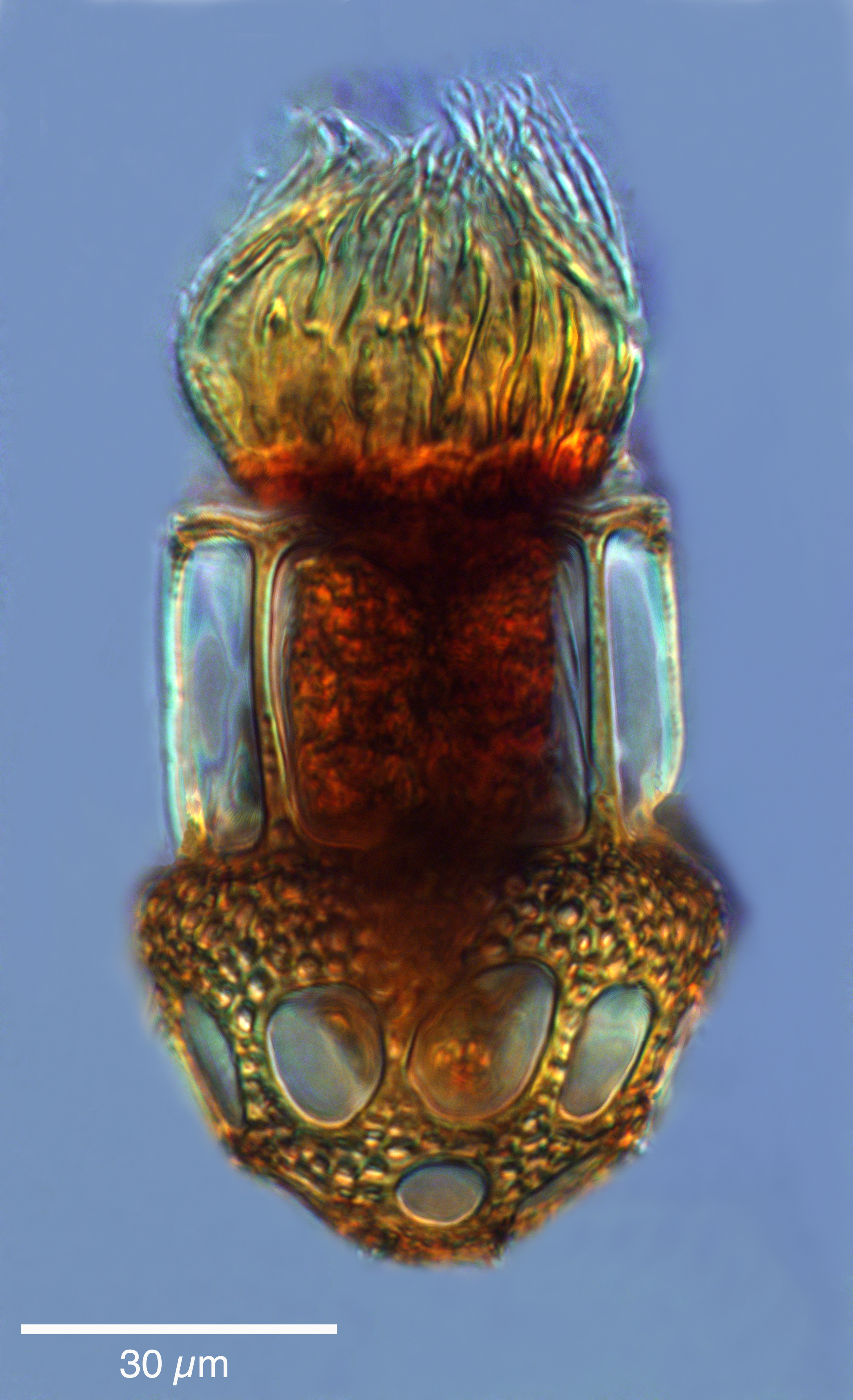 Dictyocysta lepida