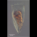 Parafavella parumdentata morphotype