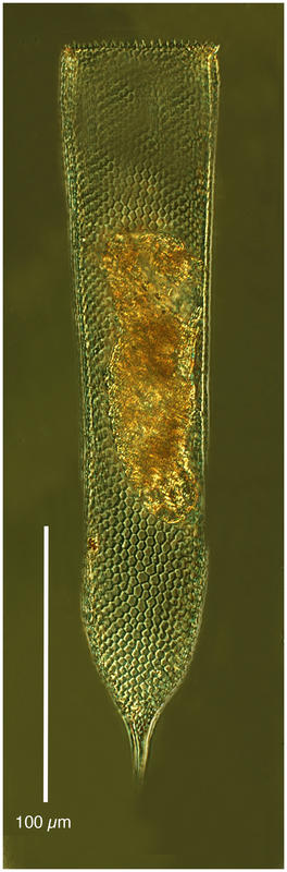 Parafavella robusta